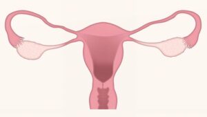 Candidoza vaginala - cauze si tratament