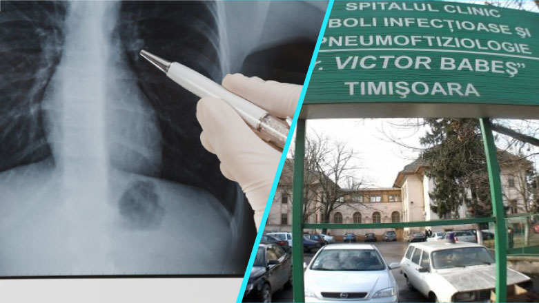 Spitalul Victor Babes Timisoara: Riscul de cancer pulmonar este mai mare dupa 55 de ani