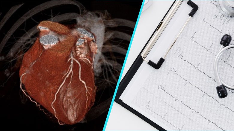 Cercetarea cardiologilor din Targu Mures, in cea mai prestigioasa revista medicala din lume