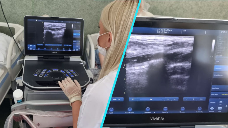 Timisoara: Radiologii vor face ecografii de san, la patul pacientelor internate