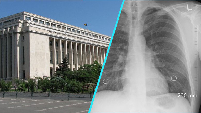 Guvernul a aprobat Strategia Nationala de Control al Tuberculozei in Romania