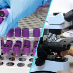 Studiu: Un tratament inovator impotriva hemofiliei a prezentat rezultate incurajatoare