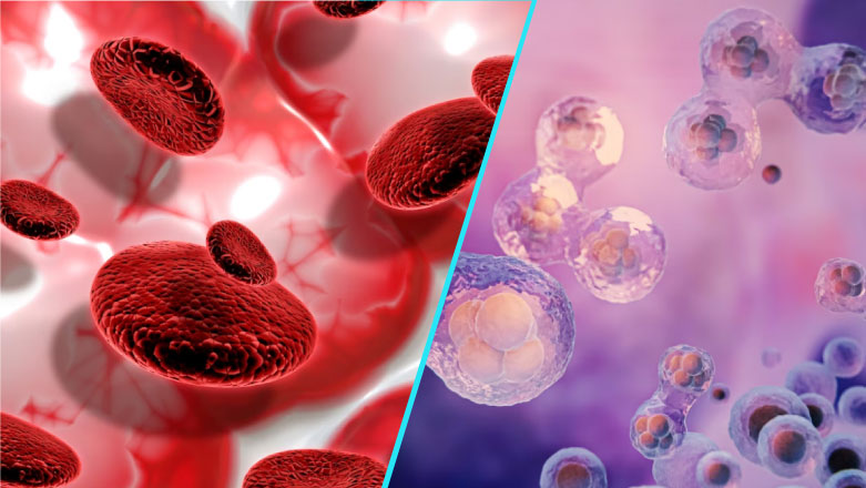 Transplantul de celule stem hematopoietice – un tratament eficient pentru cancerele de sange