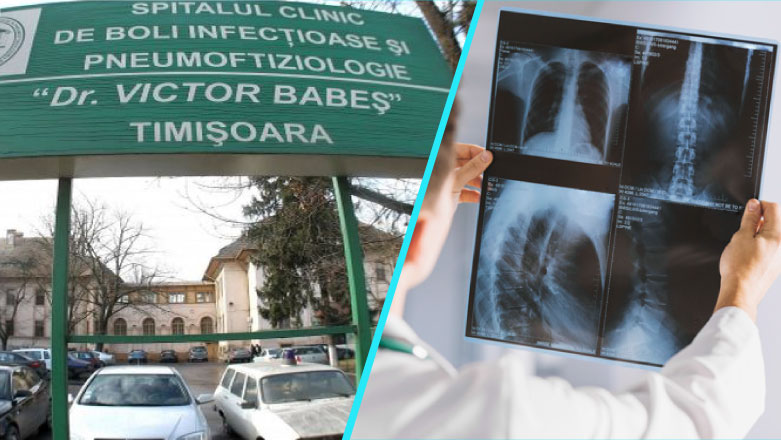 Diagnostic molecular in cazurile de cancer pulmonar, la Spitalul Victor Babes Timisoara