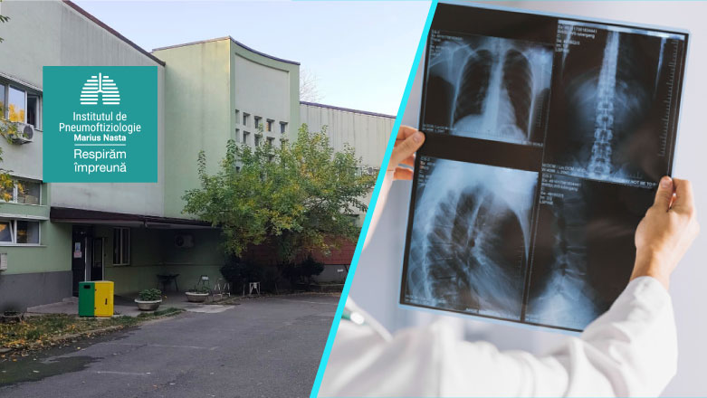 Tuberculoza multirezistenta va putea fi diagnosticata in circa doua ore, la Institutul ‘Marius Nasta’