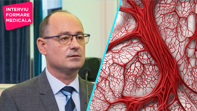 BVC | Dr. Laurentiu Stoicescu: Patologia venoasa este intr-o crestere permanenta
