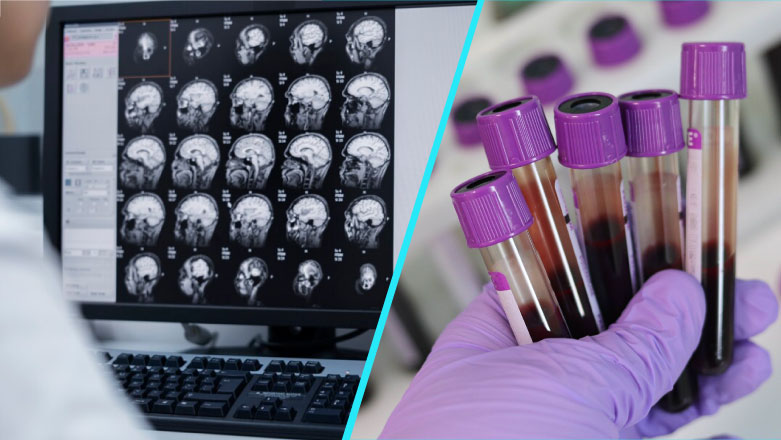 Cercetatorii de la Stanford Medicine au dezvoltat un test de sange care detecteaza cancerul