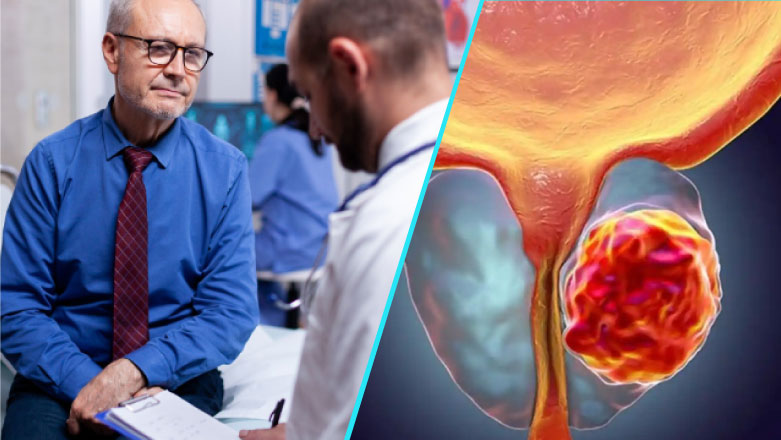 PSA – testul care poate semnala prezenta cancerului de prostata inainte de primele simptome