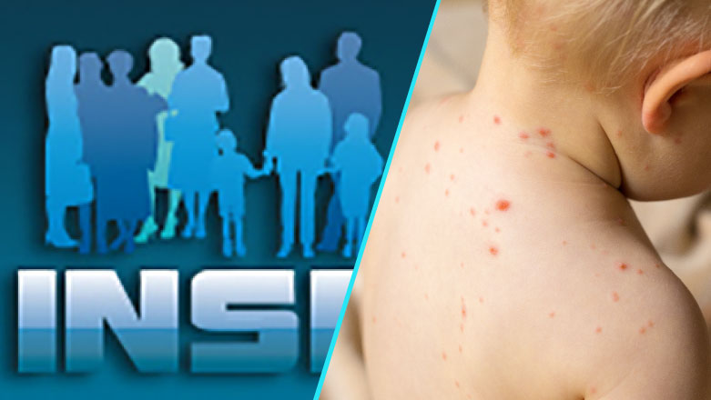 Peste 1.000 de cazuri de rujeola inregistrate in luna mai