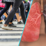 Romania, fara scut in fata cancerului pulmonar: Niciun program national de screening