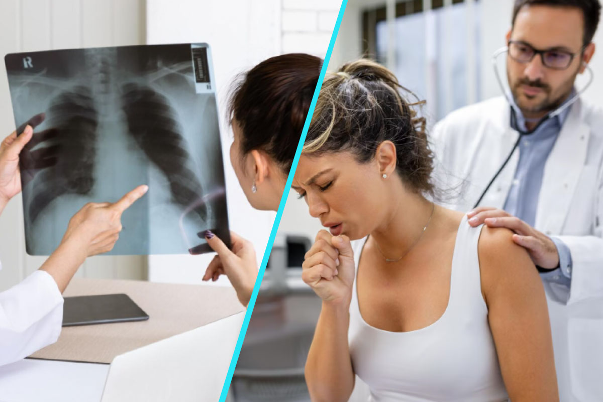 BPOC, boala in expansiune | Semnal de alarma pentru sanatatea pulmonara