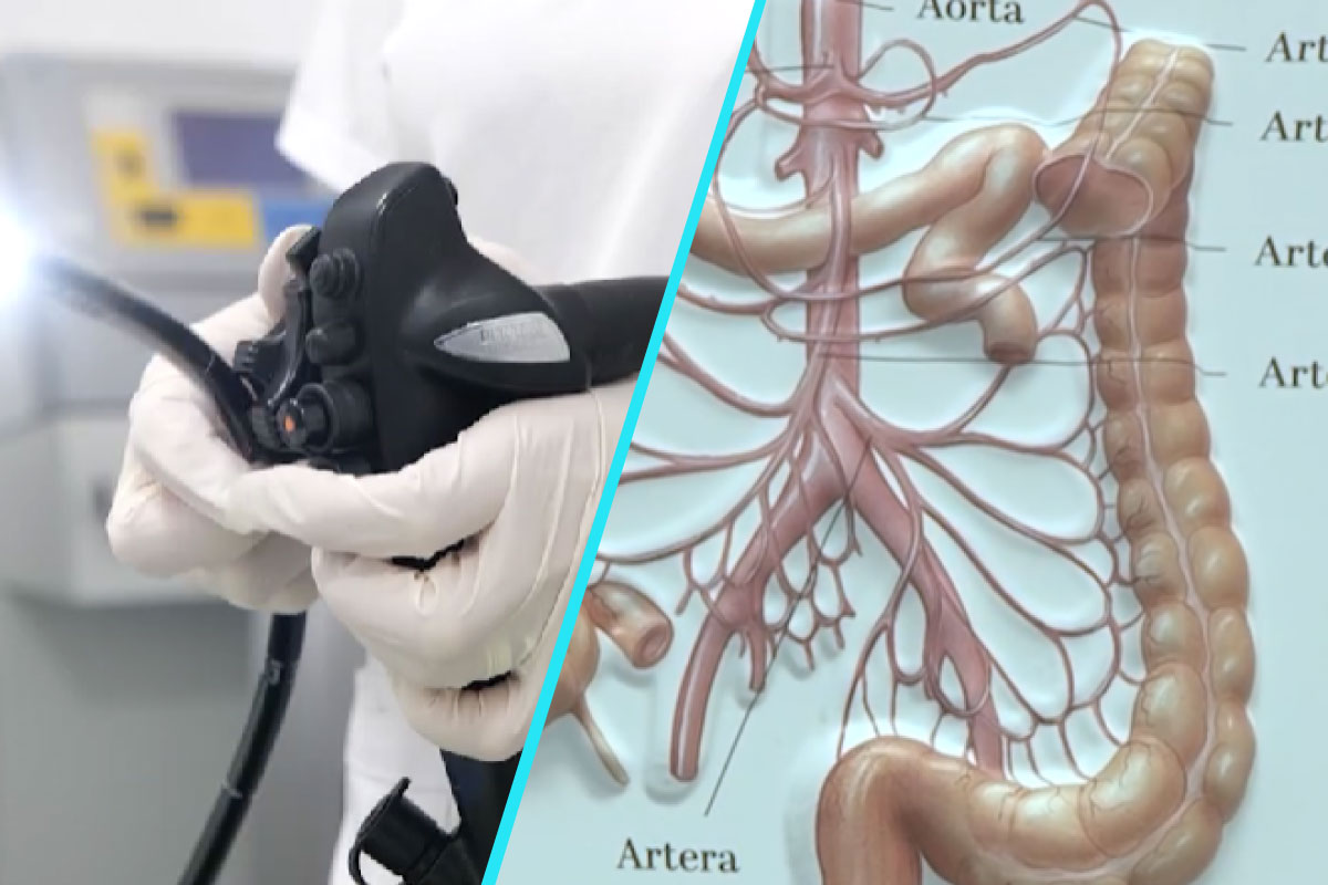 Gastroscopia – investigatia vitala pentru depistarea precoce a cancerului gastric