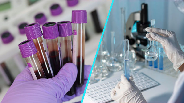 Hepatitele B si C pot fi depistate gratuit | De ce diagnosticul precoce conteaza