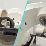 Radioterapie de precizie | Un accelerator liniar care schimba ritmul tratamentelor oncologice