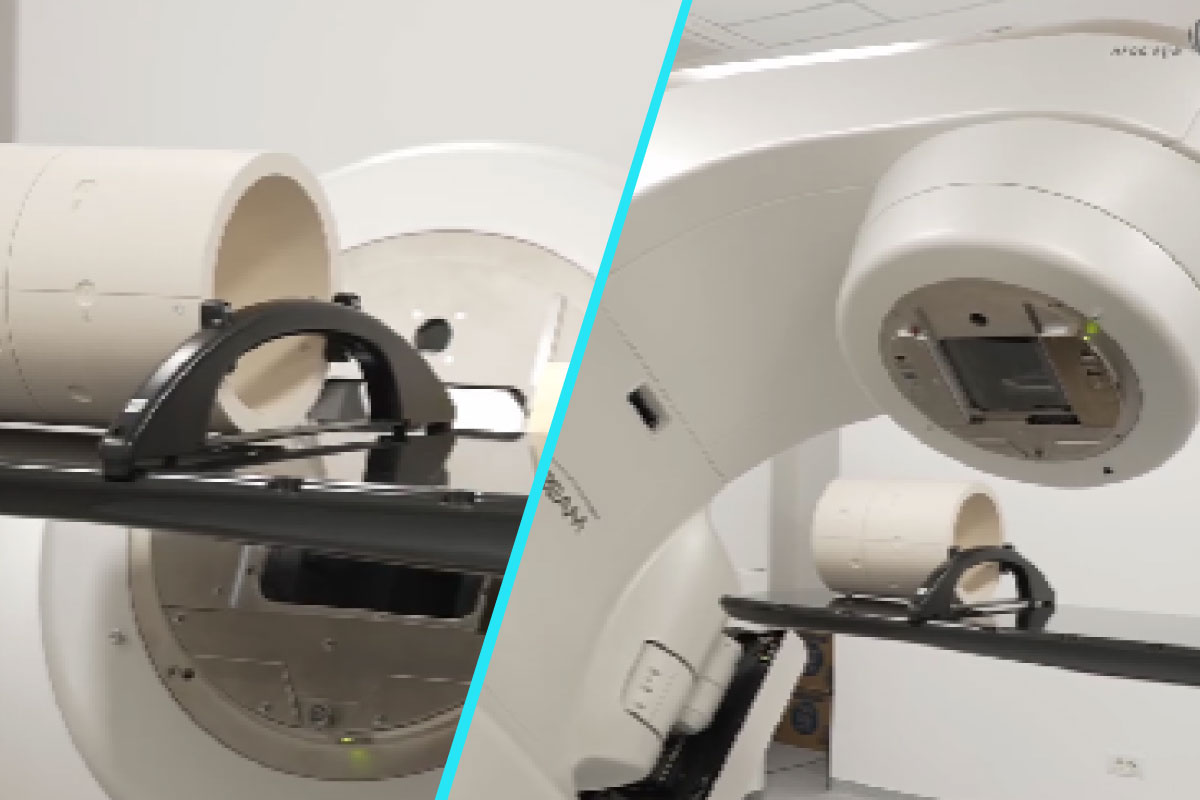 Radioterapie de precizie | Un accelerator liniar care schimba ritmul tratamentelor oncologice