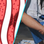 Ce este trombofilia si de ce poate deveni periculoasa