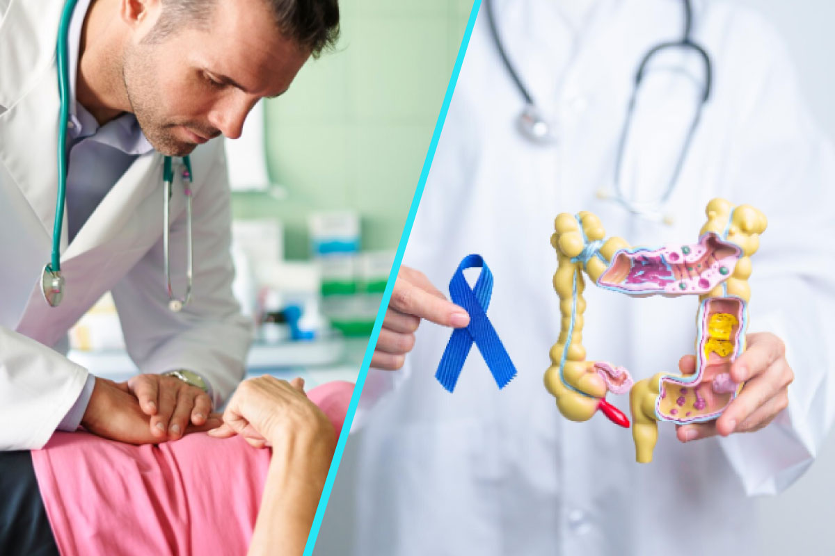 Cancerul colorectal, ucigasul tacut | Simptome, diagnostic si metode eficiente de screening