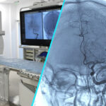 Tehnologie de top pentru tratamentul AVC | Spitalul Judetean Sibiu, centru de referinta