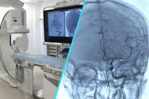 Tehnologie de top pentru tratamentul AVC | Spitalul Judetean Sibiu, centru de referinta