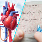 Legatura vitala dintre inima si rinichi | Sindromul cardio-renal: evaluare si tratament