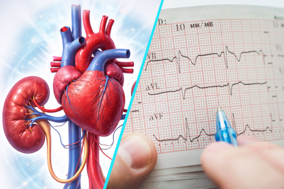 Legatura vitala dintre inima si rinichi | Sindromul cardio-renal: evaluare si tratament
