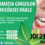 Inflamatiile orale, risc ignorat | Webinar creditat EMC despre cauze si tratamente moderne