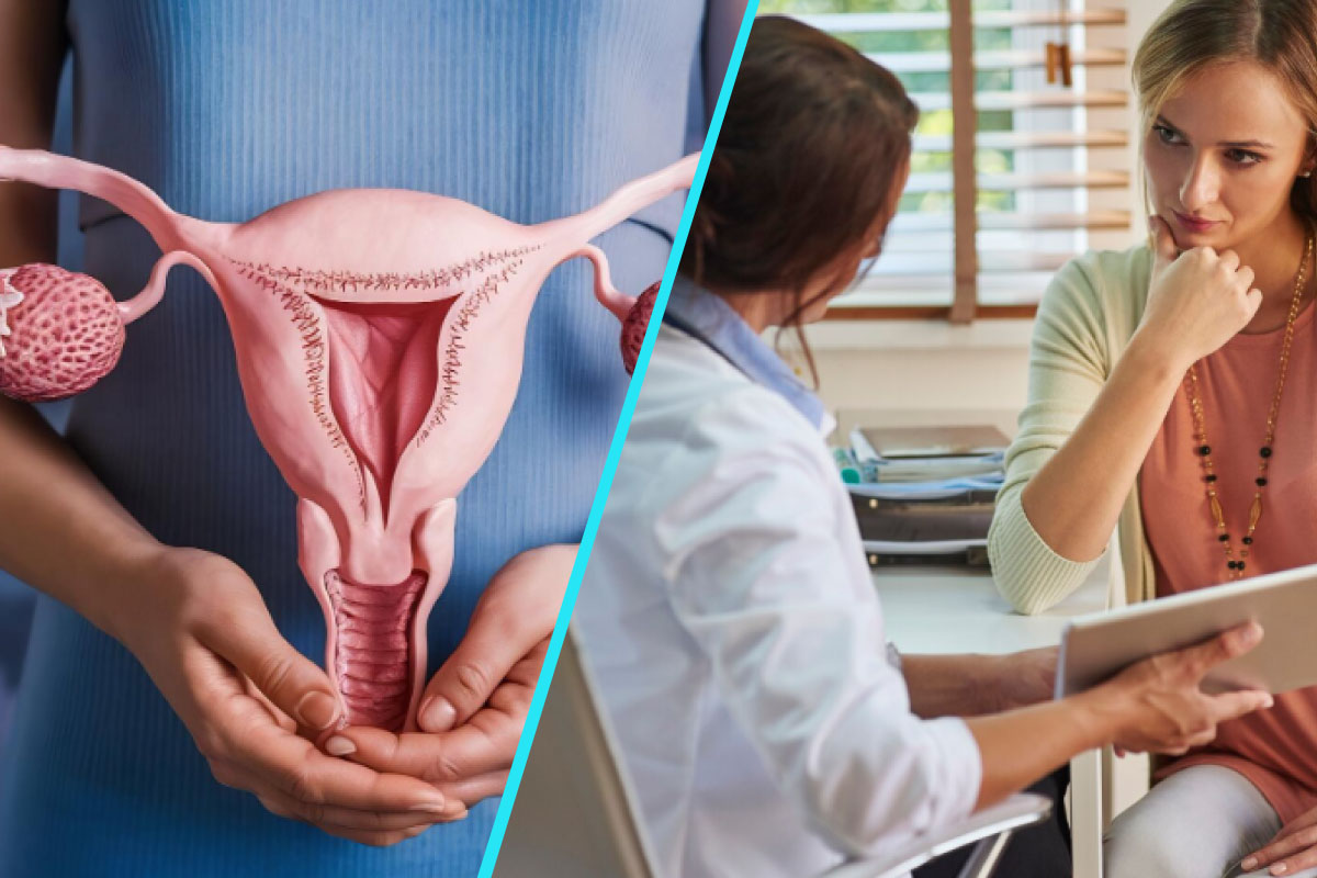 Cancerul ovarian, descoperit prea tarziu in 3 din 4 cazuri | Ghid pentru recunoasterea simptomelor