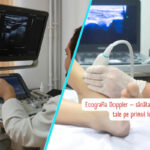 Picioare umflate sau dureroase? Simptomele care pot ascunde riscul de tromboza