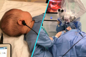 Sansa la auz pentru copiii cu hipoacuzie: Implanturi cohleare la Spitalul Dr. Victor Gomoiu