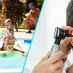 Otita externa sau “otita de piscina” | Cand se recomanda consultul ORL