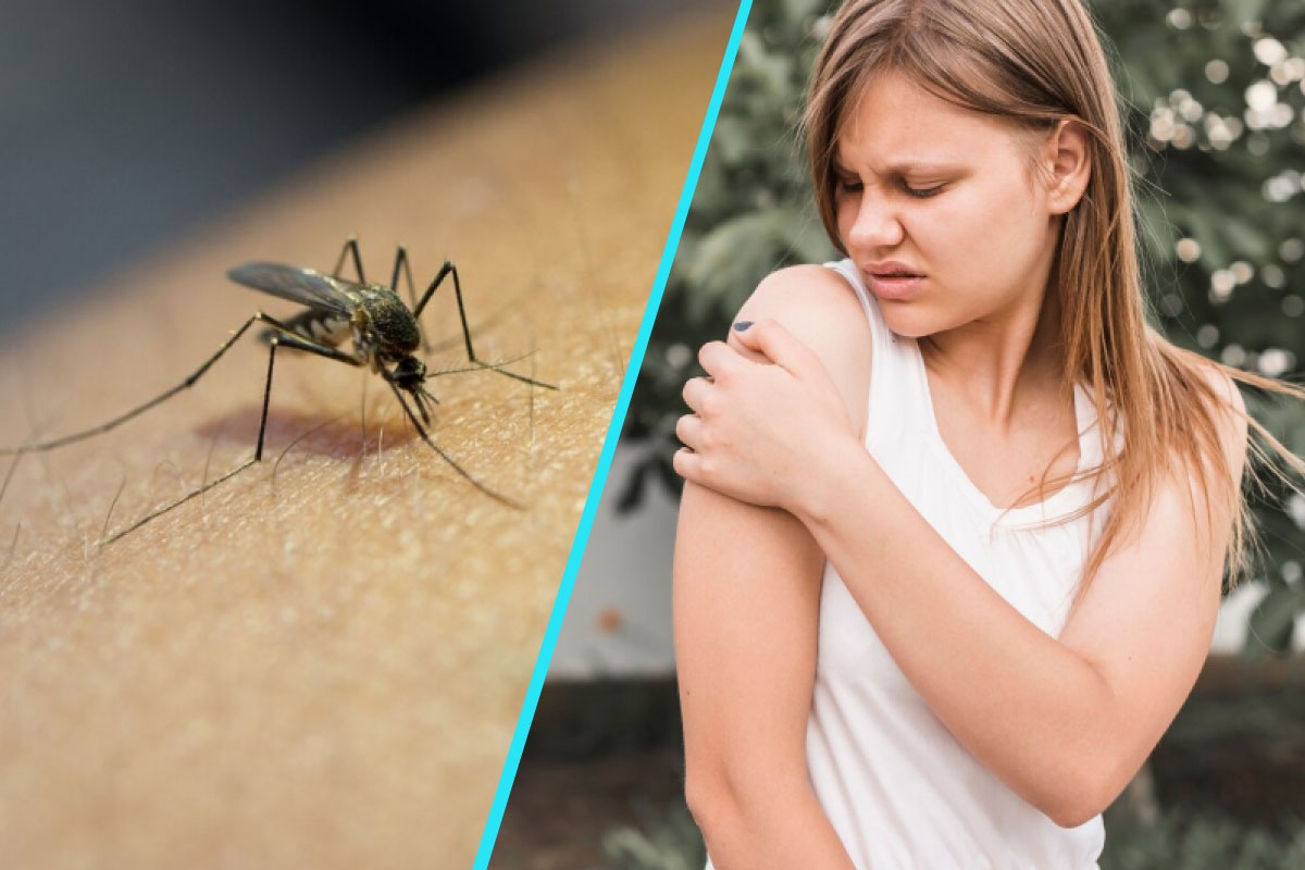 Nu ignora intepaturile de tantar! Pericolul numit West Nile