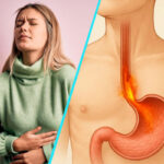 Semnele care pot indica boala de reflux gastroesofagian | Factorii favorizanti si optiunile de tratament