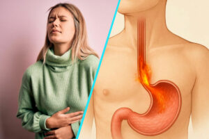 Semnele care pot indica boala de reflux gastroesofagian | Factorii favorizanti si optiunile de tratament