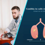 Candida in secretiile respiratorii | Cand este necesar tratamentul antifungic