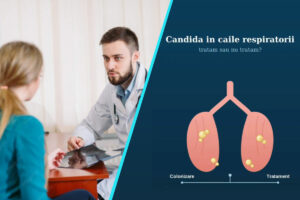 Candida in secretiile respiratorii | Cand este necesar tratamentul antifungic
