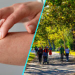 Dermatita atopica, mai mult decat “o iritatie a pielii” | Povara nevazuta a bolii