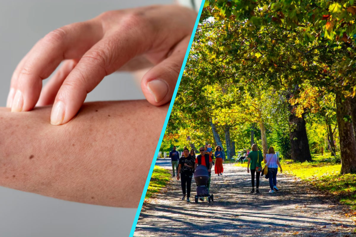 Dermatita atopica, mai mult decat “o iritatie a pielii” | Povara nevazuta a bolii