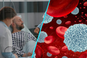 Mielom multiplu | O imunoterapie experimentala a redus cu 60% riscul de progresie sau deces