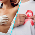 Dupa aproape 10 ani, UE aproba o noua terapie de prima linie pentru cancerul mamar HER2-pozitiv
