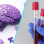 Un test de sange si o analiza genetica pot anticipa aparitia simptomelor bolii Alzheimer cu pana la sase ani