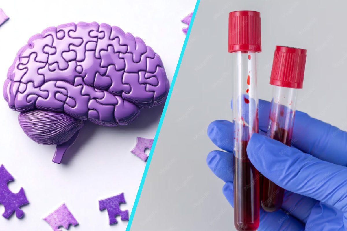 Un test de sange si o analiza genetica pot anticipa aparitia simptomelor bolii Alzheimer cu pana la sase ani