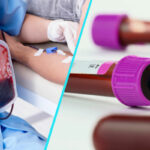 Hemovigilenta in spitale | Noi reglementari pentru raportarea reactiilor adverse severe