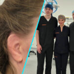 Premiera medicala la Spitalul Clinic Judetean Bistrita | Reconstructie integrala de ureche
